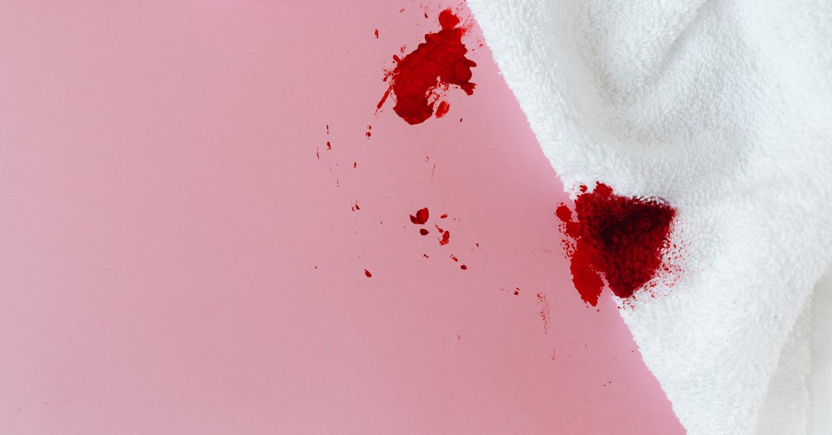 découvrez tout sur le blanchiment, ses méthodes, avantages et précautions à prendre pour obtenir des résultats éclatants tout en préservant la santé de vos dents et de votre peau.